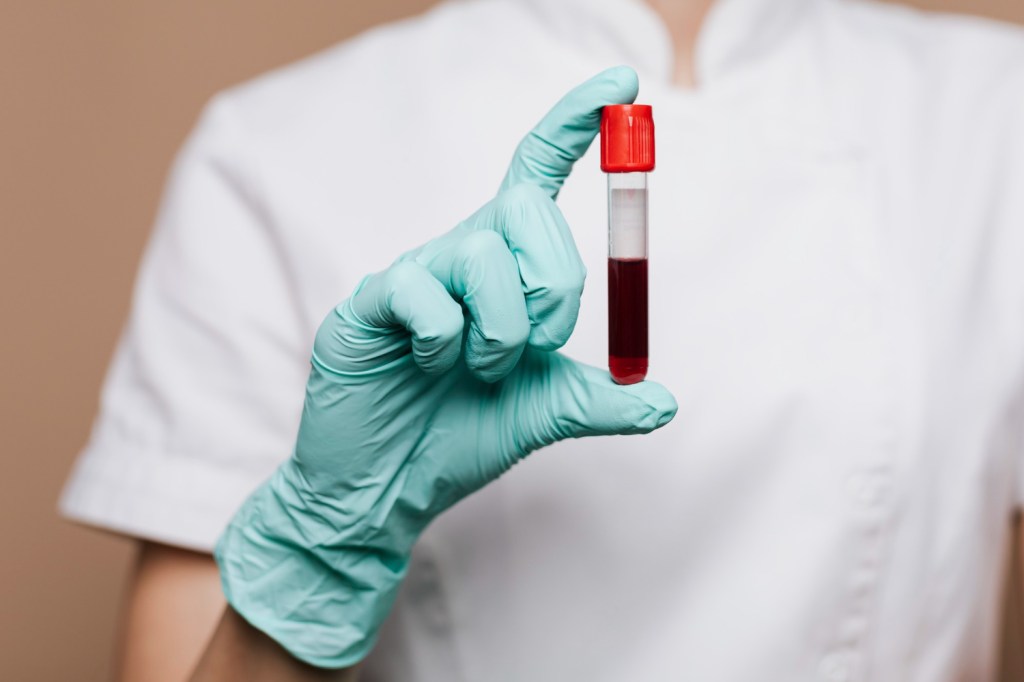 Are Blood Tests Enough to Detect All STDs